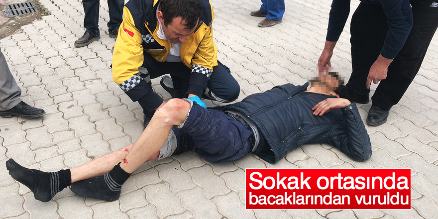 Sokak ortasında bacaklarından vuruldu