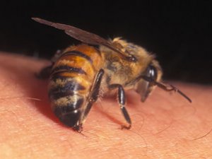 Arı alerjisi öldürebilir!