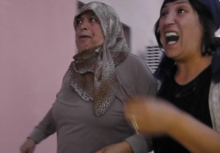 Dilini eşek arısı soktu