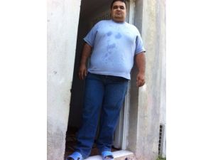 Kadirlili 180 Kiloluk Obezite Hastası Tedavi Olmak İstiyor