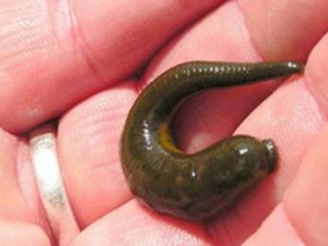 Sülük Hastanelik Etti