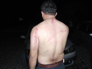 Karakolda Kavga: 3'ü Polis 6 Yaralı