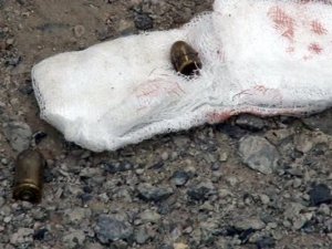 Göğsünden giren mermiyi öksürerek çıkardı
