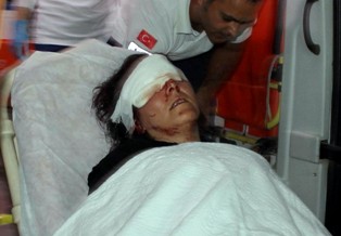 Koca dayağı kaşını patlattı