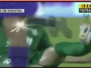 Futbolcunun ayağı feci şekilde kırıldı