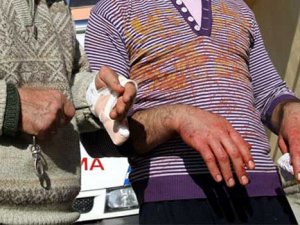 Acemi kasaplar hastanelik oldu