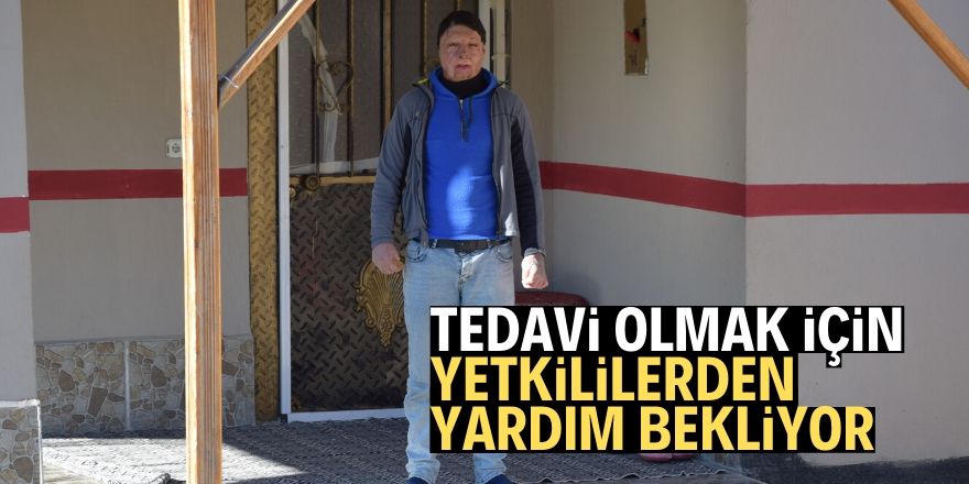 Yüzü yanan genç yardım istiyor