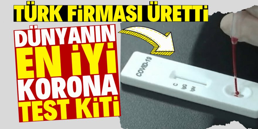 Türk karı-koca koronavirüs testi için kit üretti