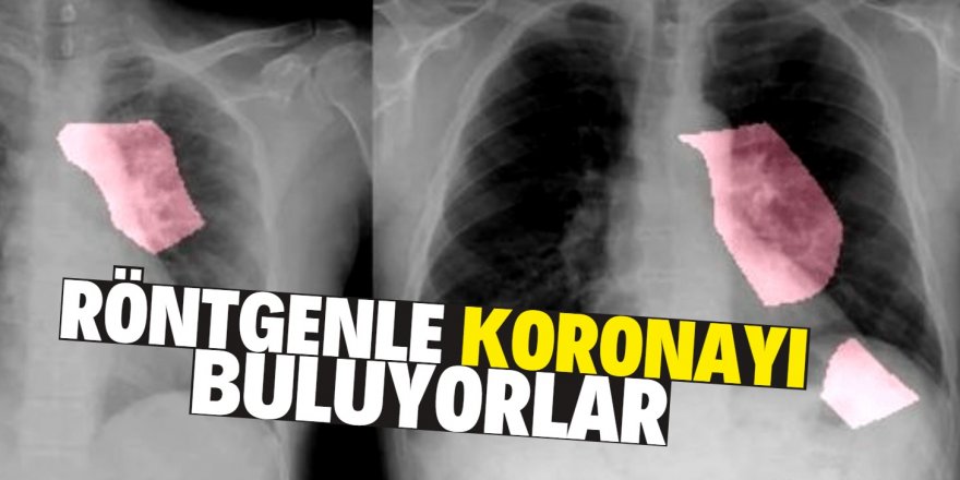 Koronavirüs teşhisinde yeni gelişme!