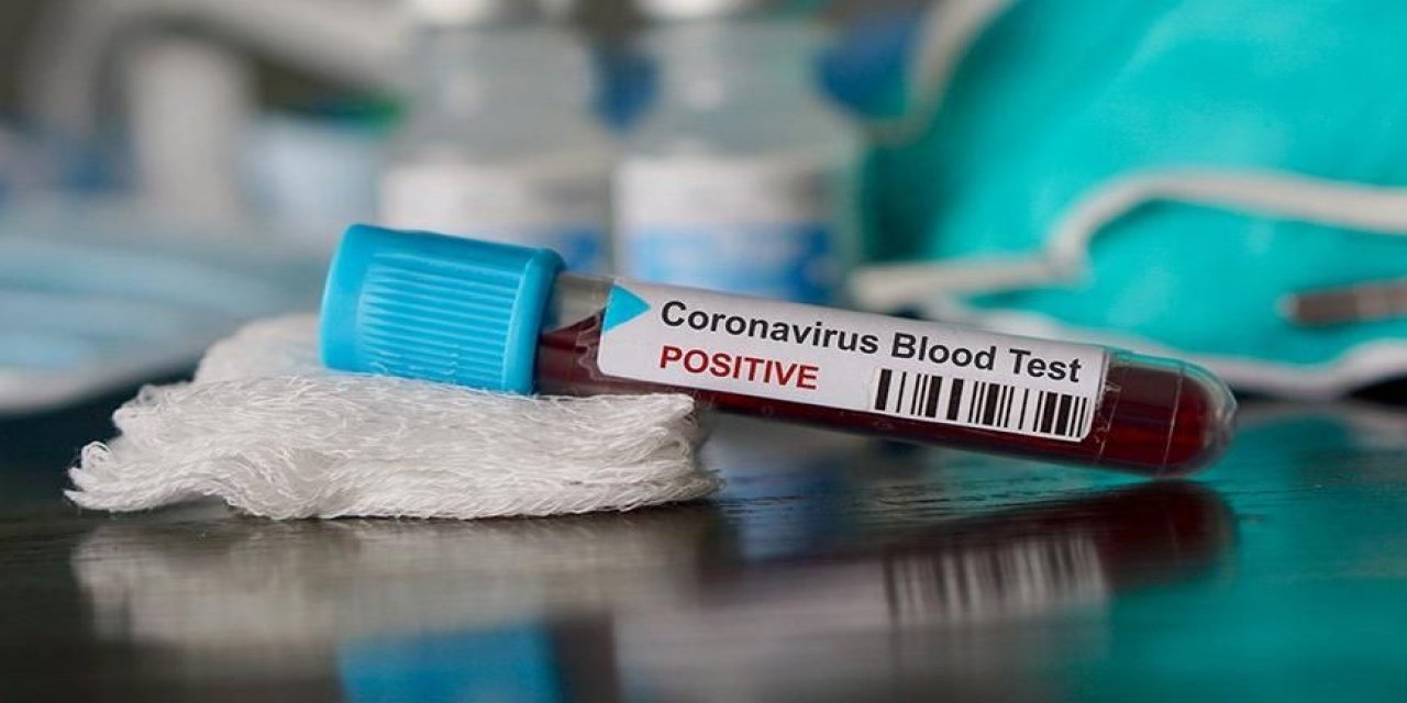 Koronavirüse karşı en riskli kan grubu hangisi?