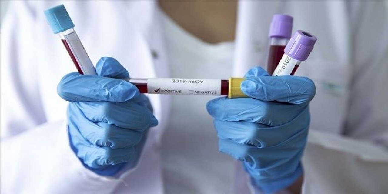 Dünya genelinde yeni tip koronavirüs vaka sayısı 31 milyonu aştı
