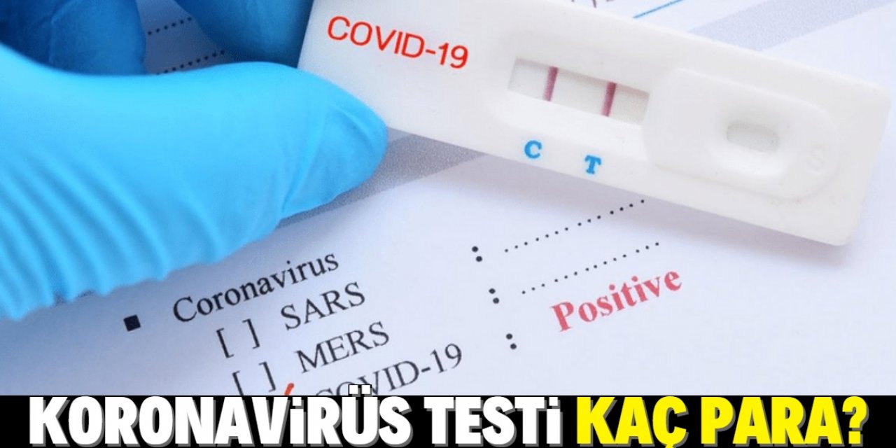 Koronavirüs test ücreti ne kadar? Covid-19 PCR test ücreti 2020