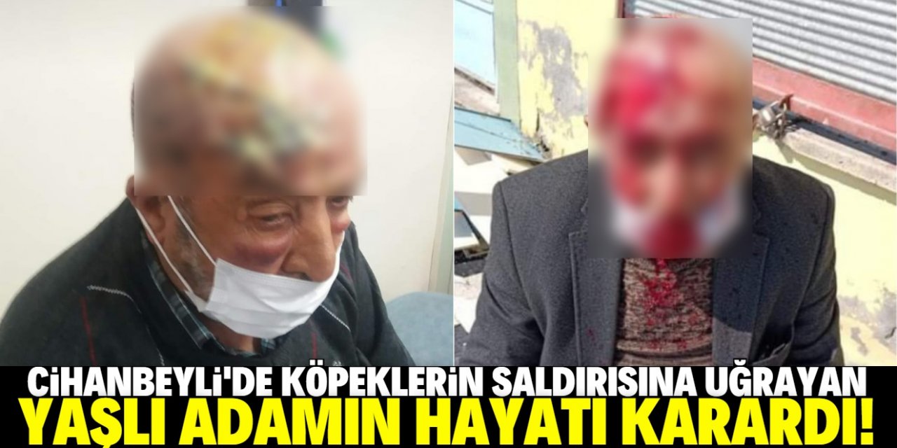 Köpek saldırısına uğrayan adamın kafa derisi koptu!