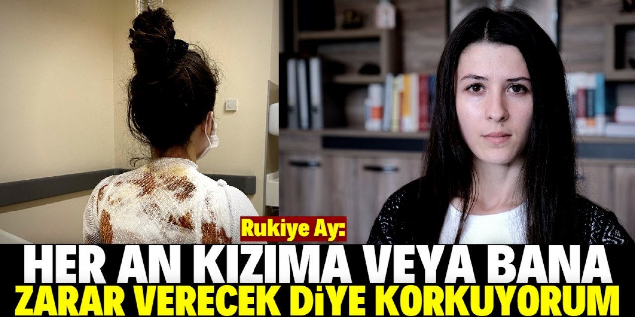 Eşinin sıcak suyla haşladığı Rukiye: Yaptığı işi yarım bırakmayacak