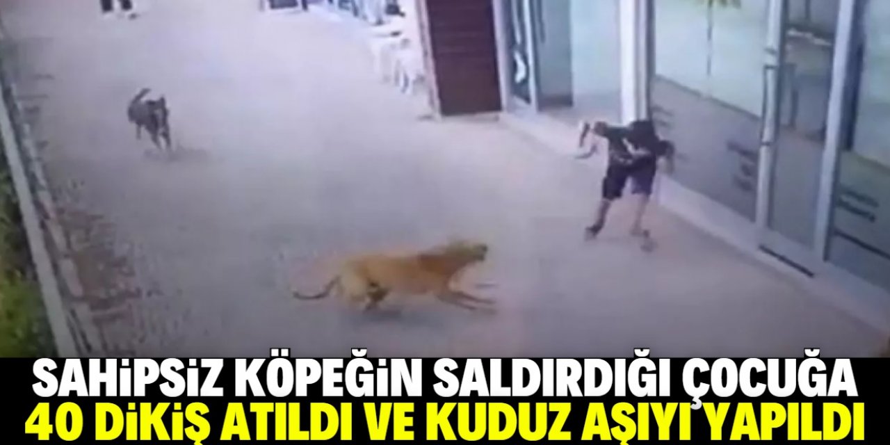 Konya'da sahipsiz köpeğin saldırdığı 9 yaşındaki çocuğa 40 dikiş atıldı