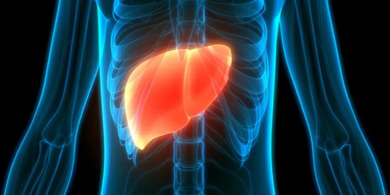 Karaciğer yağlanması nelere yol açar?