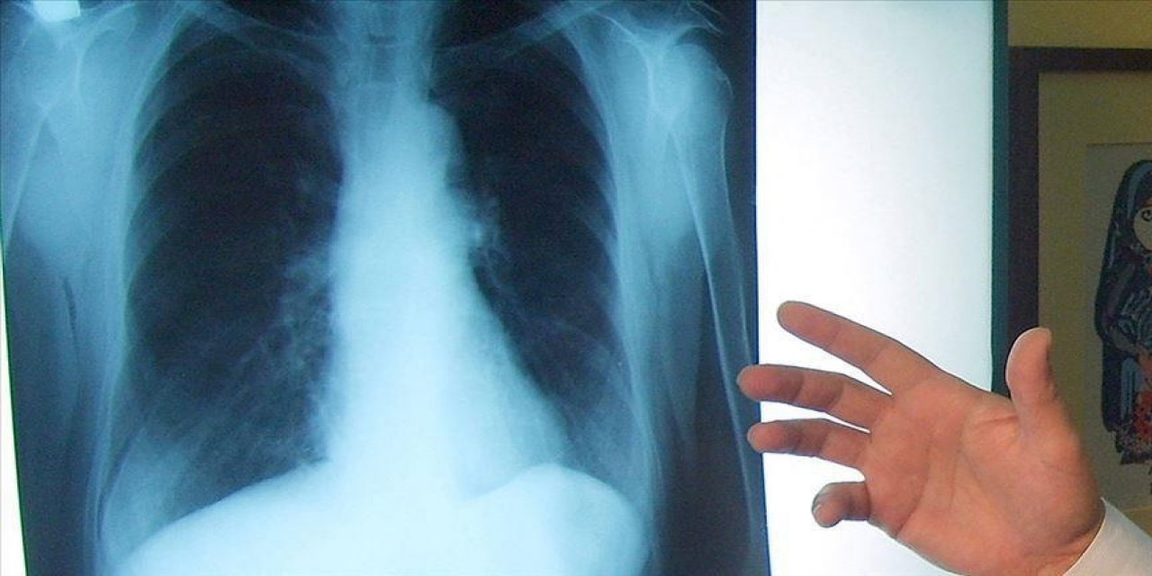 Ege Üniversitesinde borik asidin akciğer kanseri tedavisine yönelik etkisi araştırılacak