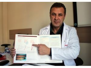 Genç Bayan Hastalığı Reynoya Dikkat Edilmeli