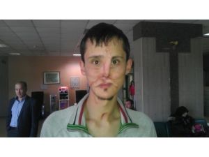 Yüz Nakli Olmak İçin Yola Çıkan Recep Kaya Uçağı Kaçırınca Çok Korktu