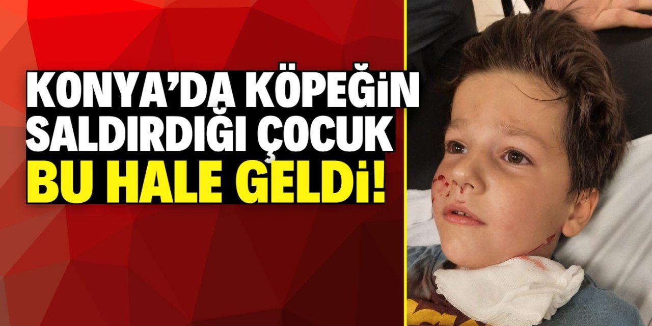 Konya'da köpeğin saldırdığı çocuk yaralandı