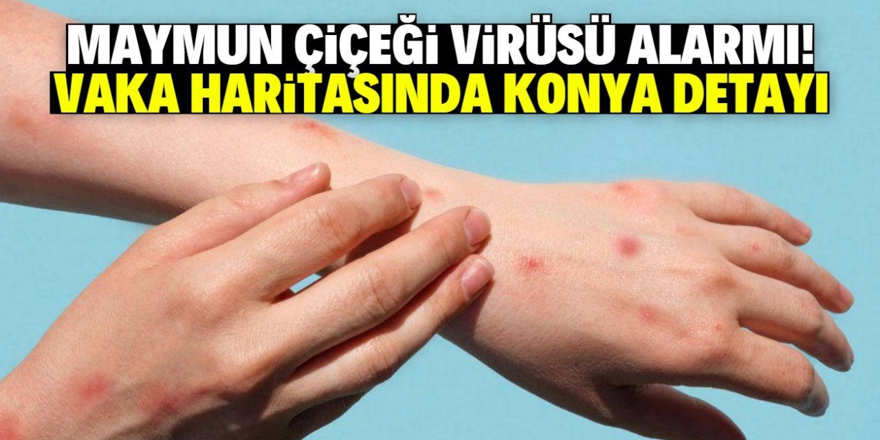 Maymun çiçeği virüsü alarmı! DSÖ haritasında Konya detayı dikkat çekti