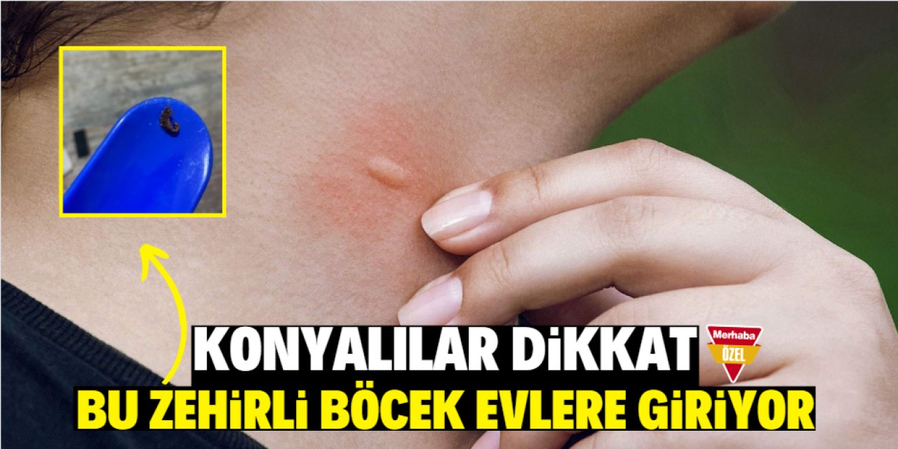 Konyalılar dikkat! Bu zehirli böcek evlere giriyor