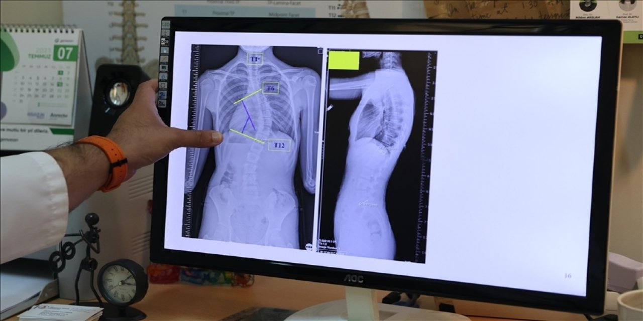 Özellikle kız çocukları bu hastalığa dikkat etsin!