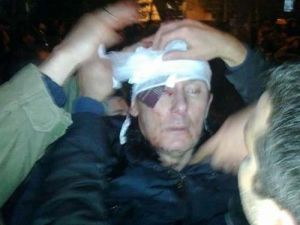Ukrayna'da Eski İçişleri Bakanı Lutsenko Ağır Yaralandı