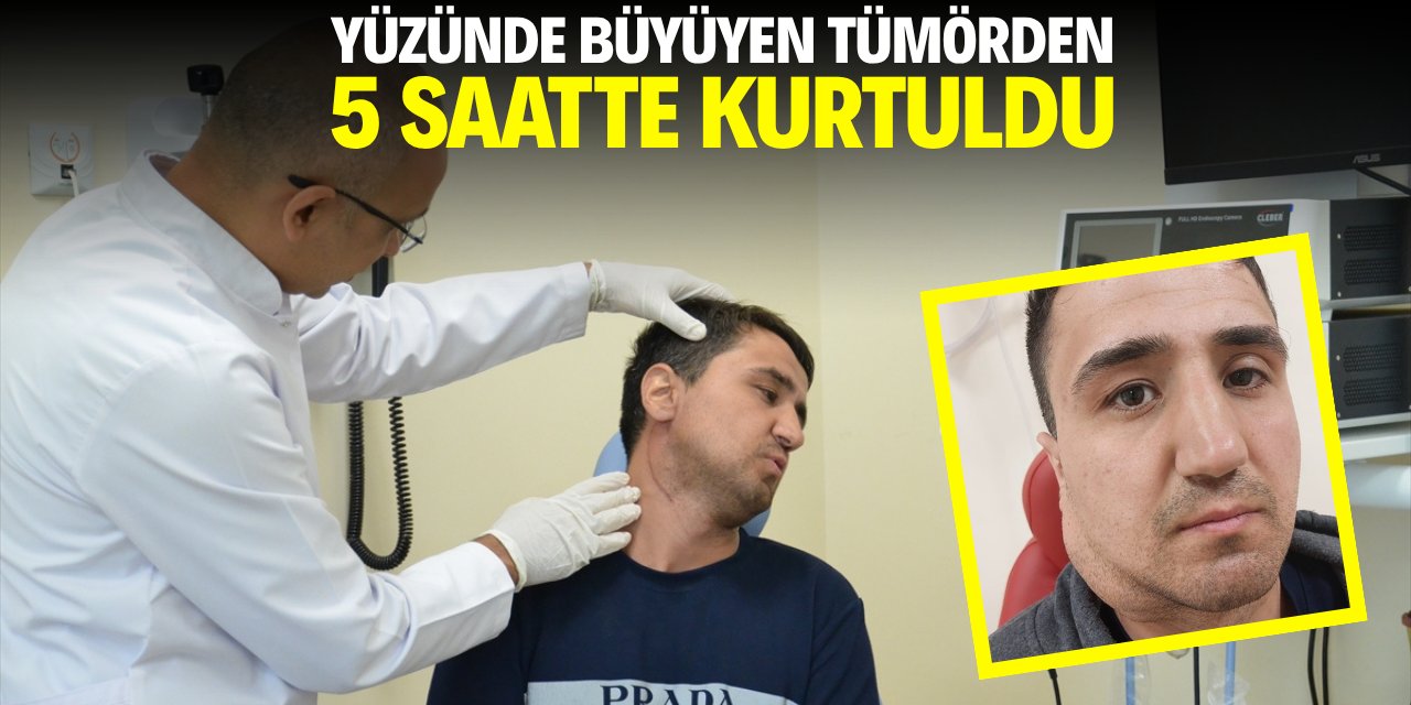Yüzünde büyüyen tümörden 5 saatte kurtuldu