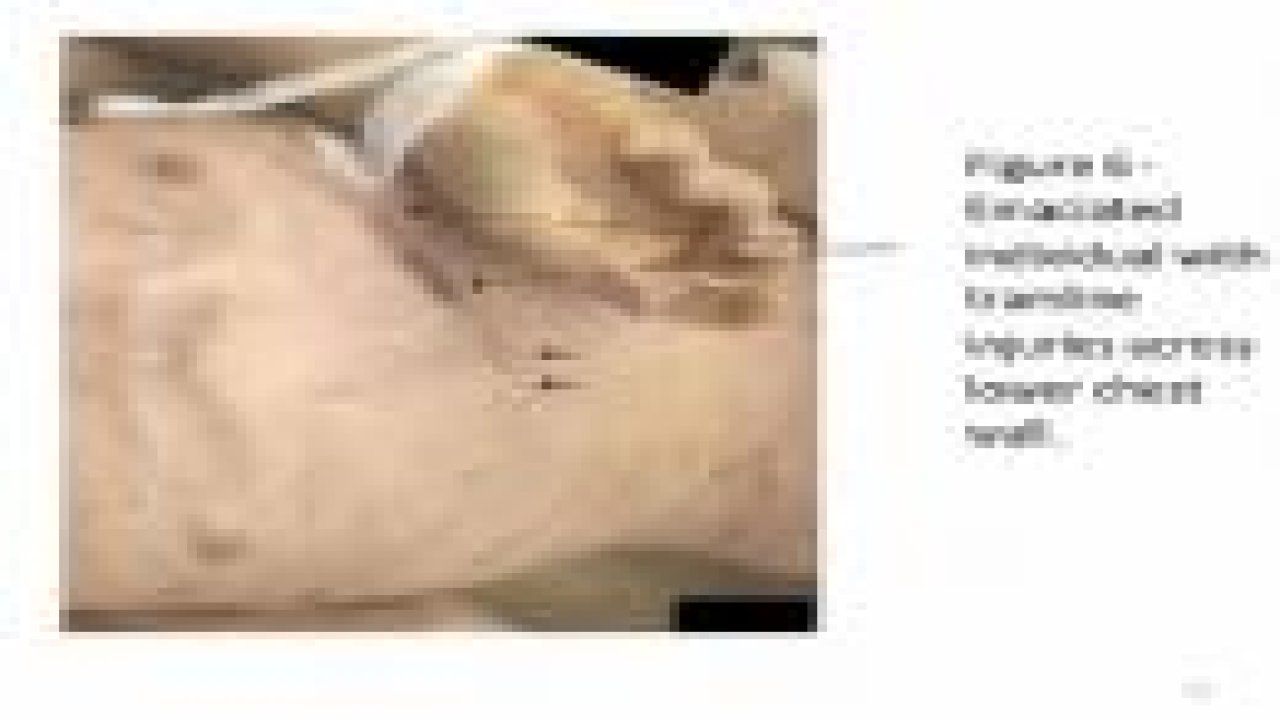 Suriye'de insanlık dışı görüntüler