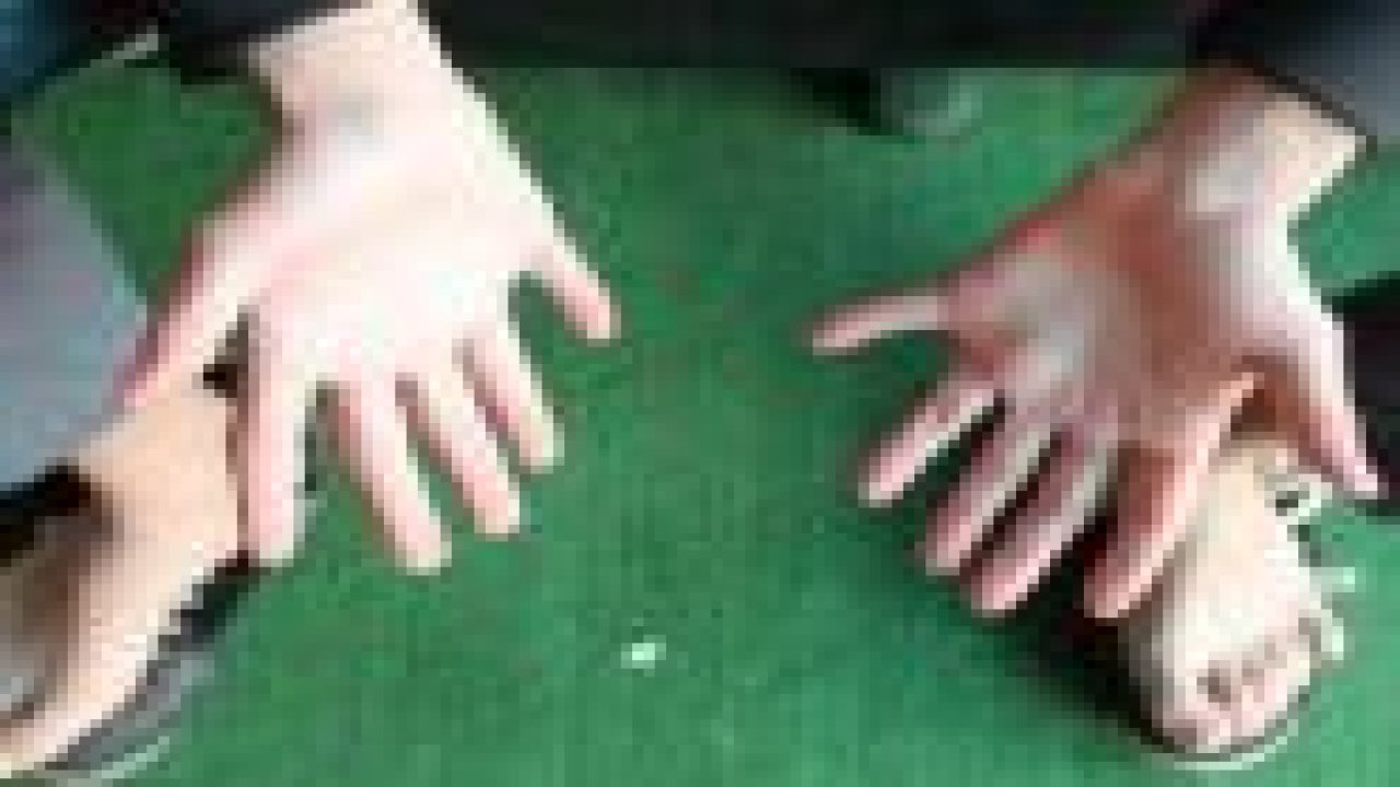24 parmaklı lise öğrencisi şaşırtıyor