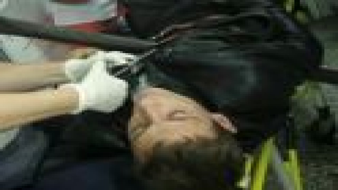 Vücuduna 2 metre demir boru girdi ama...