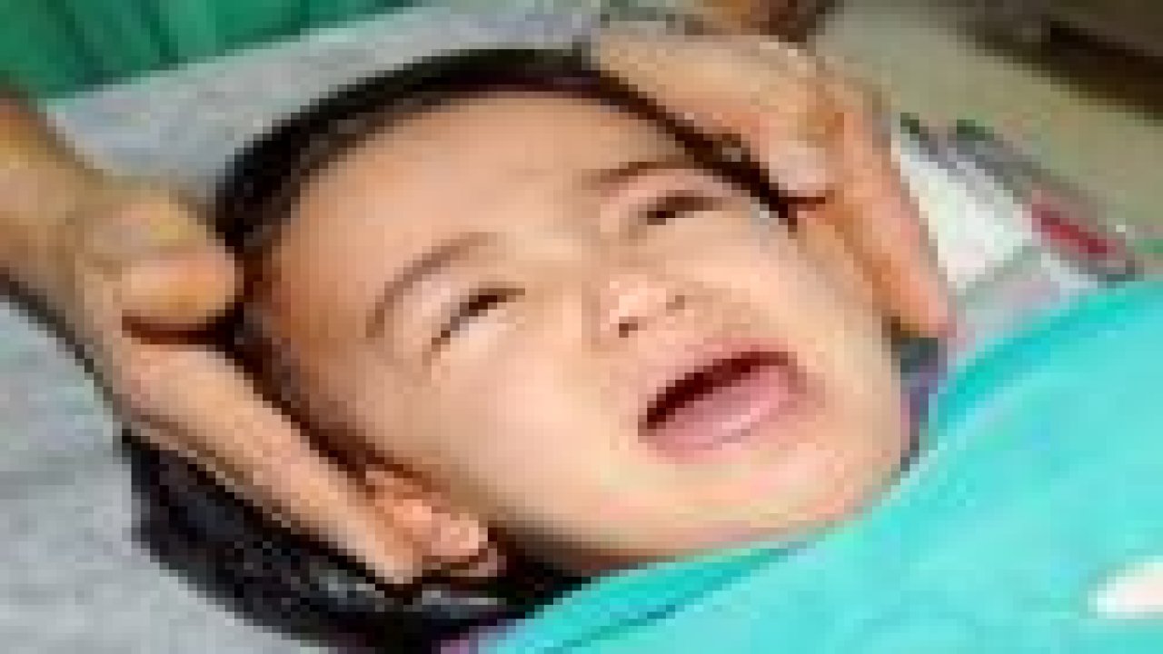 Burnundan çıkanlar doktorları şok etti!