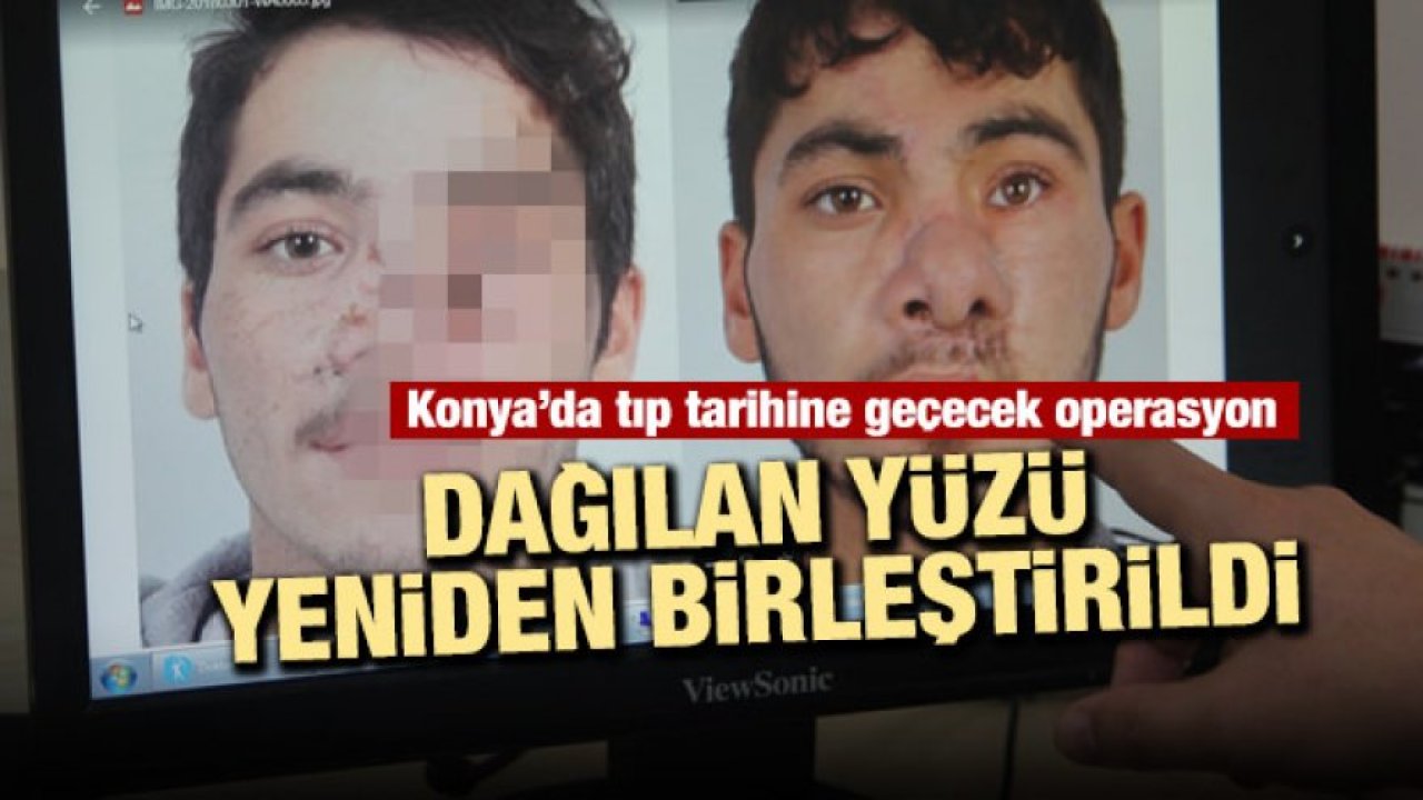 Dağılan yüzü, vücudundan alınan parçalarla birleştirildi