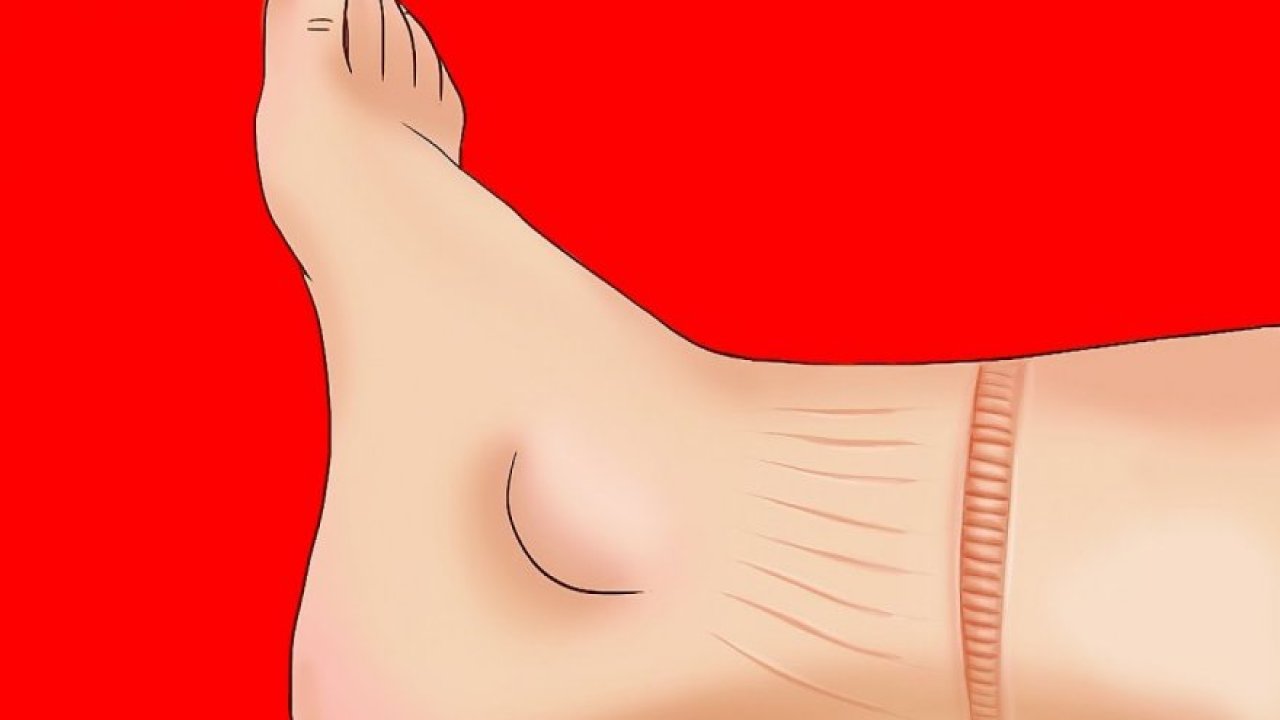 Kalbinizin Düzgün Çalışmadığını Gösteren 10 İşaret