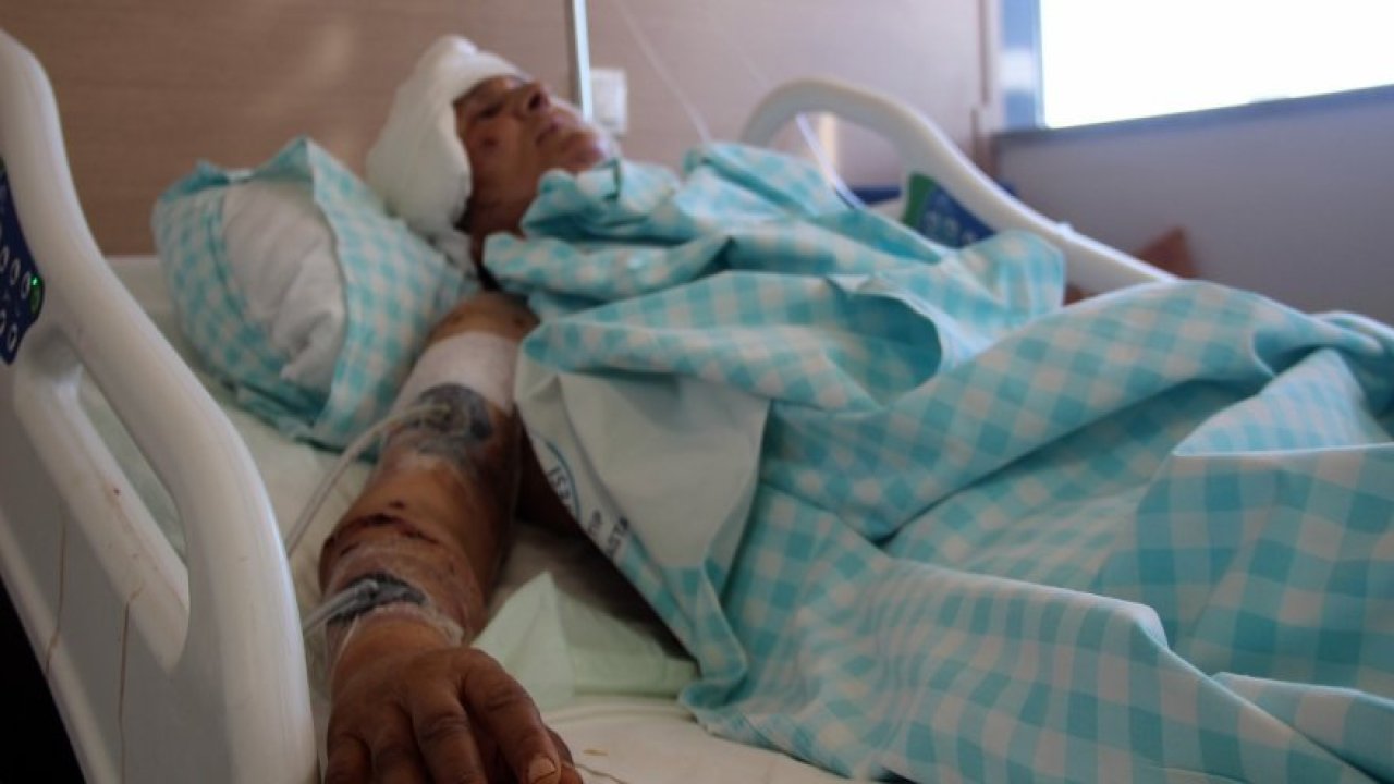 Köpeklerin Saldırısına Uğrayan Kadın Yaşadığı Dehşet Anlarını Anlattı