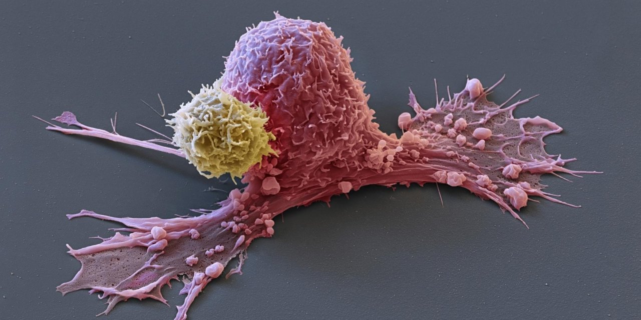 İmmünoterapi ile kanserde tedavi başarısı artıyor