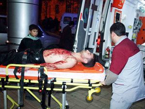 Karısına kızınca, kendini jiletledi