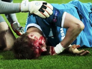 Yıldız futbolcu kanlar içinde kaldı