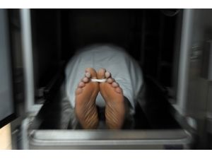 Geçen Yıl Ki Ölümlerin Yüzde 39,8’i Dolaşım Sistemi Kaynaklı