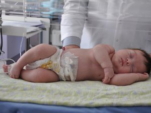 Bir günlük Pervin bebeğe ameliyat