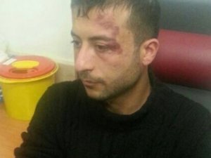 Saldırgan AK Parti üyesi çıktı