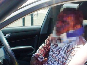 Birbirlerinin kulaklarını bıçakla kopardılar