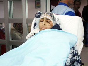 Karısının kafasına keserle vurdu