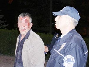 Laf attığı iddiasıyla hastanelik oldu