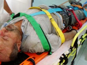 Elektriğe kapıldı düşerek yaralandı