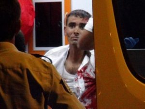 Kendisini bıçaklayanın otomobilini yakmaya kalktı