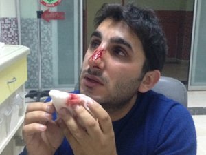 Yüzüne şişe fırlatılan ambulans şoförü yaralandı