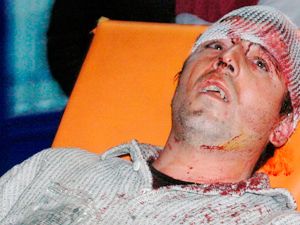 Önce demir sopayla dövüp, sonra gasp ettiler