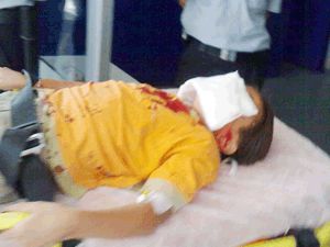 Saldırgan, 9 yaşındaki çocuğun yüzünü kesti